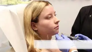 Voluma Filler on the Chin with Dr. Wu