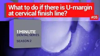 What to do if there is U-margin (undercut) at cervical finish line? 1 dental minute