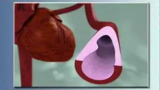 Heart Health