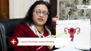 Lybrate | Dr Rakhi Gupta Talks About Common Ladies Problems
