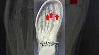 Kobe 9 Elite Protro On X-Ray Is Wild