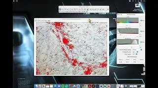 Particle counting with FIJI (simple analysis)