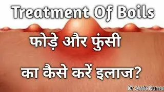 Treatment Of Boils | फोड़े और फुंसी का कैसे करें इलाज?