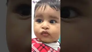 Incomplete Cleft Lip Repair | Before - After | Dr Parit Ladani