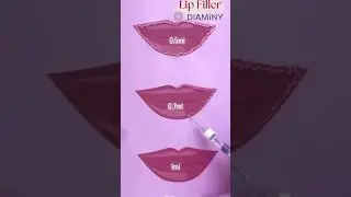 Transform Your Lips with Diaminy Dermal Filler 💞👄