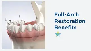 Full-Arch Benefits in Dallas TX: Dr. Phillips | Park Cities Oral & Maxillofacial Surgery Associates