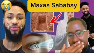 Adigane Tanookalo Yeeynan Kugudhicin‼️Magaraneysaa Geerideda Waxa Sababy‼️