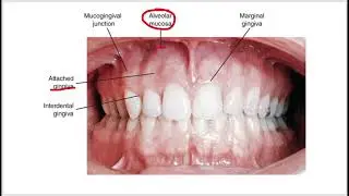 1411   03 Ch 08 and 09 Periodontium