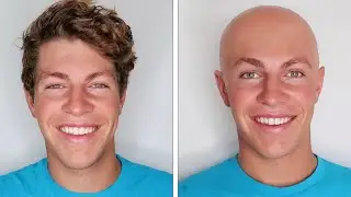 I Went Bald