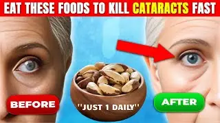 Clear Your Vision Naturally! 28 Foods for Healthy Eyes Over 50