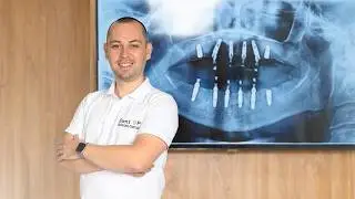 Pentru cine este indicată tehnica „Dantură Fixă pe Implanturi Dentare”? - Dr Cazacu Corrado
