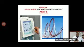 part 5 pressure volume loop waveform pitfalls ventilator graphics analysis display