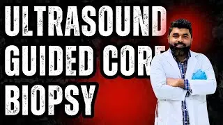 Ultrasound guided core biopsy successfully done from liver SOL | Dr. Saif's Sonography