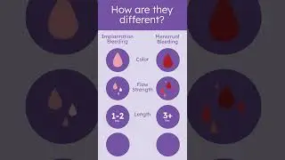 Implantation vs Period Bleeding