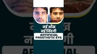 नकली आँख से मिली नई जिंदगी