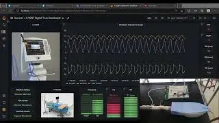 Plotting Ventilator Waveform Using Grafana Dashboard