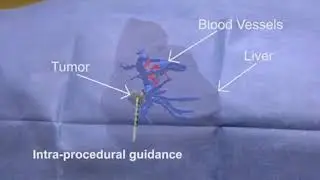 MediView Surgical Navigation Technology