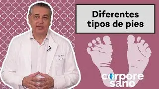 Diferentes tipos de pie [Corpore Sano]