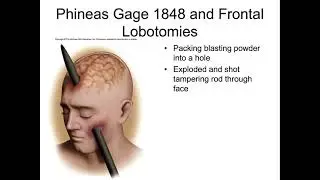 NAU Bio 201 Lab 10 &ndash; Brain and Cranial Nerves