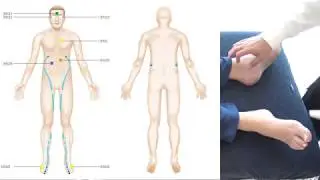 Simple Treatment with miHealth Energetic Rejuvenators (ERs)