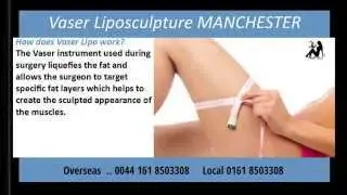 Liposuction Surgery Manchester 0800 0 30 29 30 | Vaser Liposuction Clinic Manchester