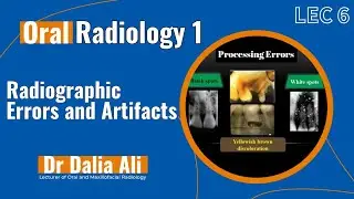 Oral Radiology 1 ; Lec 6 ; Radiographic Errors and Artifacts.
