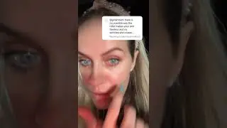 DOES BOTOX MAKE ME LOOK YOUNGER?
