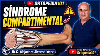 Síndrome compartimental