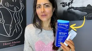 Watch How Differin (ADAPALENE) Transforms Your Skin (Game-Changer Retinoid)