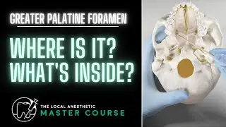 Greater Palatine Nerve Anatomy | Online Dental Continuing Education | Local-Anesthetic.com