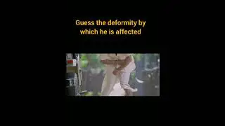 comment your answer⬇️. #newchannel #movie #physiotheraphy #supportme #deformity #bones
