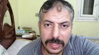 غساله ذنوسي ZQ لاتعمل شاهد تعديل مقبض غساله 01001839120 حكيم ابوغزاله