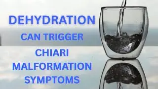CHIARI & DEHYDRATION