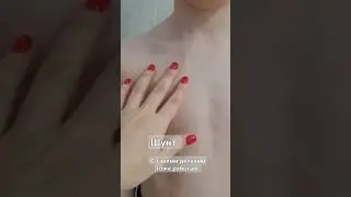 при гидроцефалии ставят шунт. #дети #гидроцефалия #массаж #мануальная_терапия #юшко