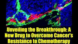 Unveiling the Breakthrough: A New Drug to Overcome Cancer's Resistance to Chemotherapy
