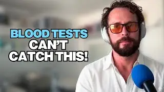 Why Hair Testing Detects Mineral Deficiencies Better Than Blood Tests!