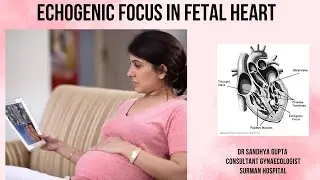 SOFT MARKERS|ANOMALY SCAN|FETAL ECHO|FETAL HEART|TIFFA SCAN|ULTRASOUND IN PREGNANCY #viralvideo #yt