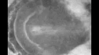 Chicken_embryo_8