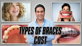 Types of Braces | Which is Right For You? | Orthodontic Treatment Price in Pakistan