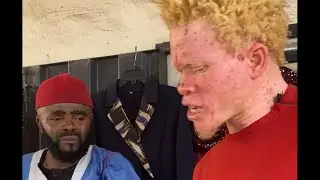 What Albino cannot do does not exist..|chief Imo #viral #comedyfilms #funny #fyp #foryou 