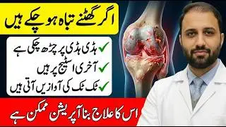 Diet/Food for Knee Pain in Urdu/Hindi | Stage 4 Arthritis | Rheumatoid RA | Ghutnu ka dard ka ilaj