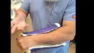 Skin Care after Cast Removal