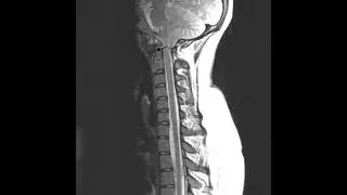 284 Hz : Spine Cervical C1 (RIFE Healing Frequency)