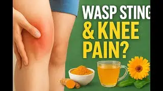 Wasp Sting & Sudden Joint Pain? Hidden Connection & Natural Relief 🌿