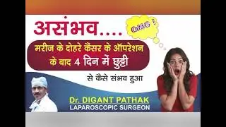 दूरबीन से आँतों के कैंसर का सफल ऑपरेशन. laparoscopic surgery for colon cancer