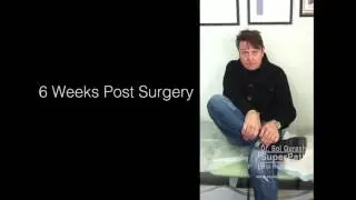 Hip Replacement | Recovery Results 6 Weeks Post Surgery