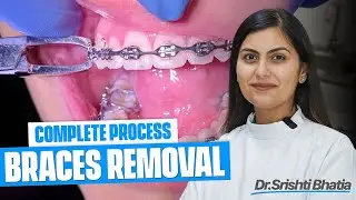 BRACES REMOVAL: Does it Hurt? (The Real Painless Process & Final SMILE REVEAL!) 😱🦷