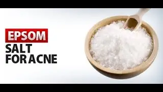 Epsom Salt for Acne