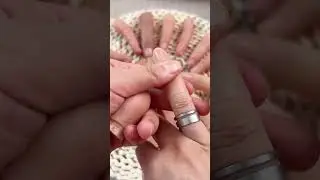 #Aesthetic Silicone Finger #Prosthesis #Amputation