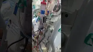 การCirculationเครื่องCRRT